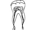 Tooth 10